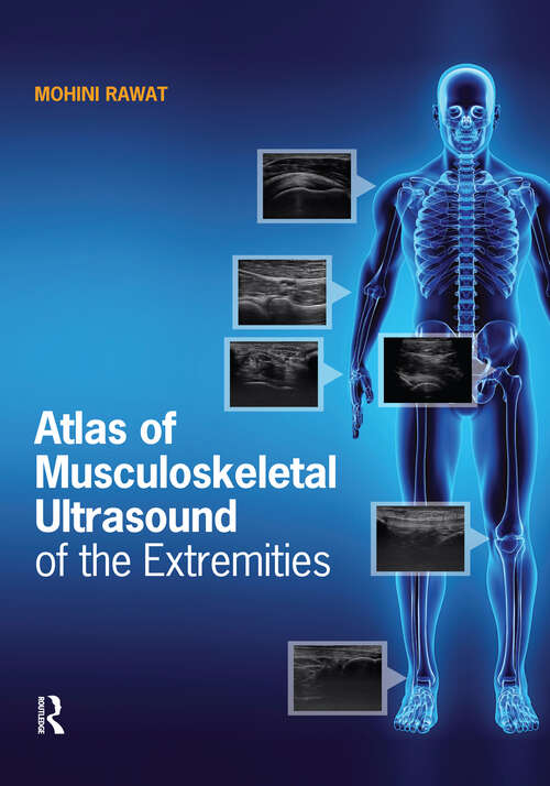 Book cover of Atlas of Musculoskeletal Ultrasound of the Extremities