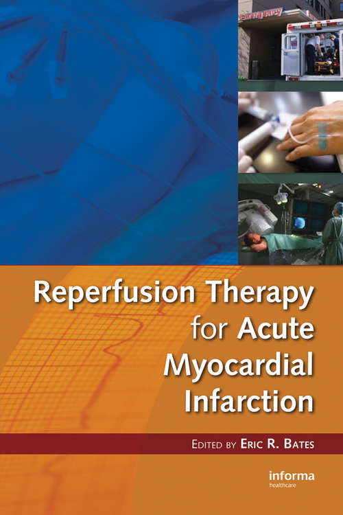 Book cover of Reperfusion Therapy for Acute Myocardial Infarction (Fundamental and Clinical Cardiology)