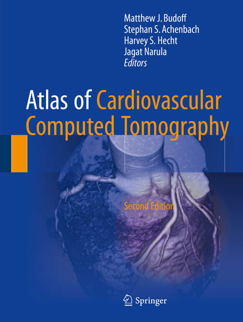 Book cover of Atlas of Cardiovascular Computed Tomography (2nd Edition): Includes Narrated Videos