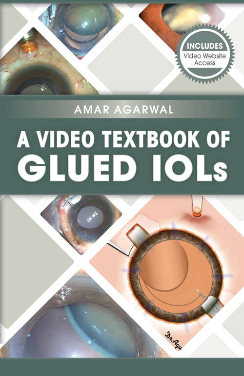Book cover of A Video Textbook of Glued IOLs