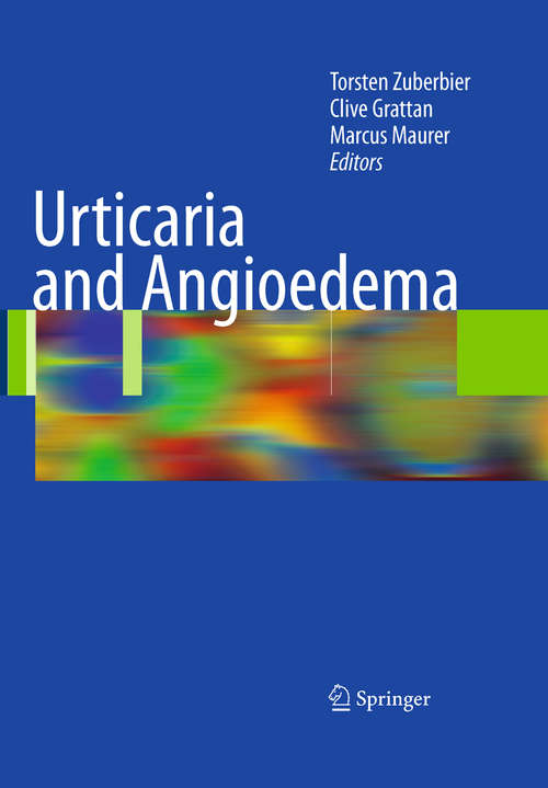 Book cover of Urticaria and Angioedema