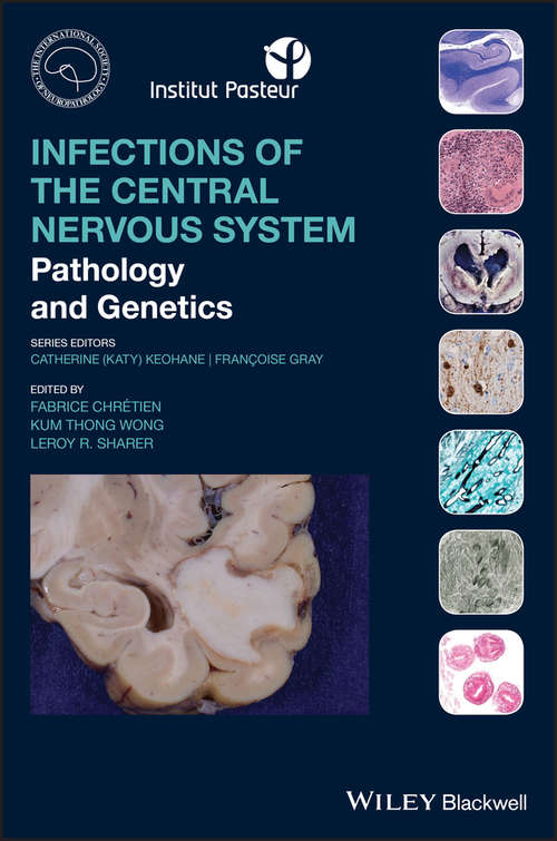 Book cover of Infections of the Central Nervous System: Pathology and Genetics (International Society of Neuropathology Series)