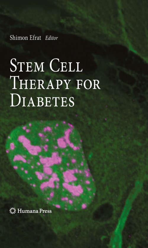 Book cover of Stem Cell Therapy for Diabetes