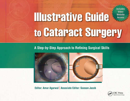 Book cover of Illustrative Guide to Cataract Surgery: A Step-by-Step Approach to Refining Surgical Skills