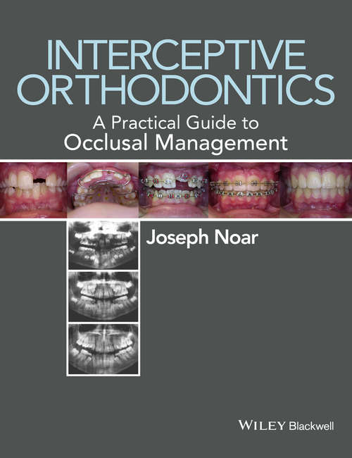 Book cover of Interceptive Orthodontics