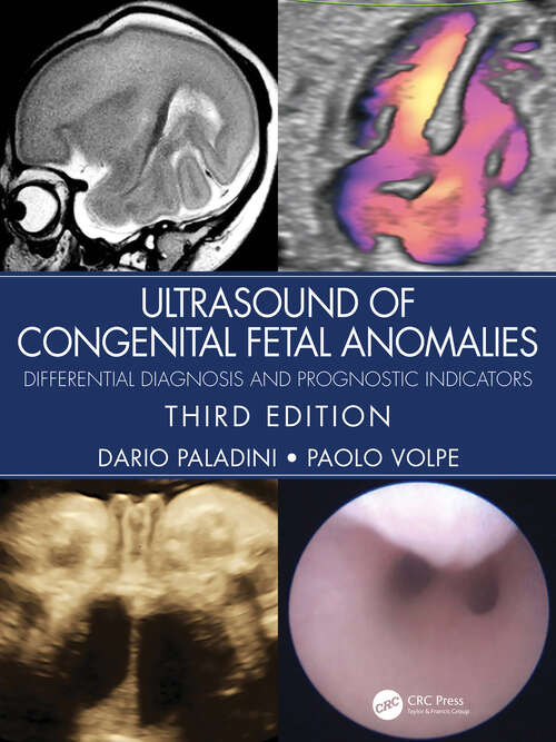 Book cover of Ultrasound of Congenital Fetal Anomalies: Differential Diagnosis and Prognostic Indicators (3)