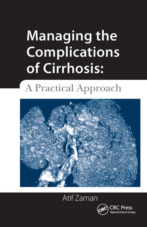Book cover of Managing the Complications of Cirrhosis: A Practical Approach