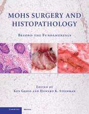 Book cover of Mohs Surgery And Histopathology: Beyond The Fundamentals