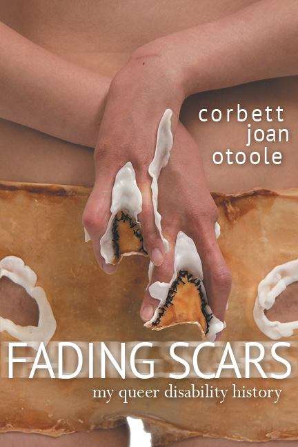 Book cover of Fading Scars: My Queer Disability History