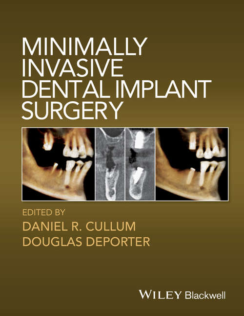 Book cover of Minimally Invasive Dental Implant Surgery