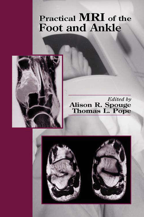 Book cover of Practical MRI of the Foot and Ankle