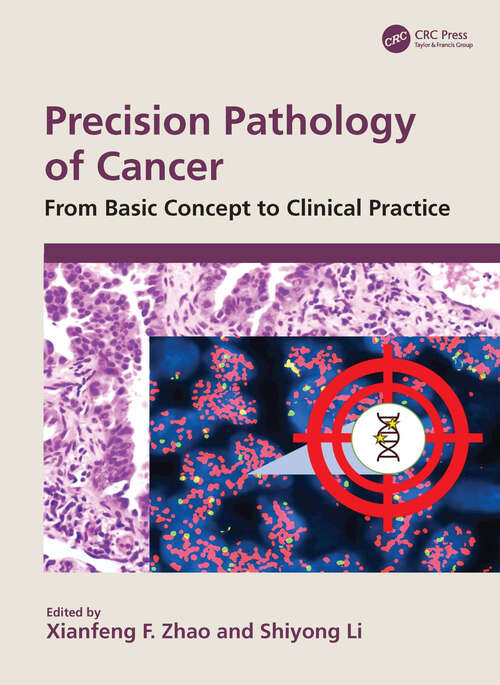 Book cover of Precision Pathology of Cancer: From Basic Concept to Clinical Practice