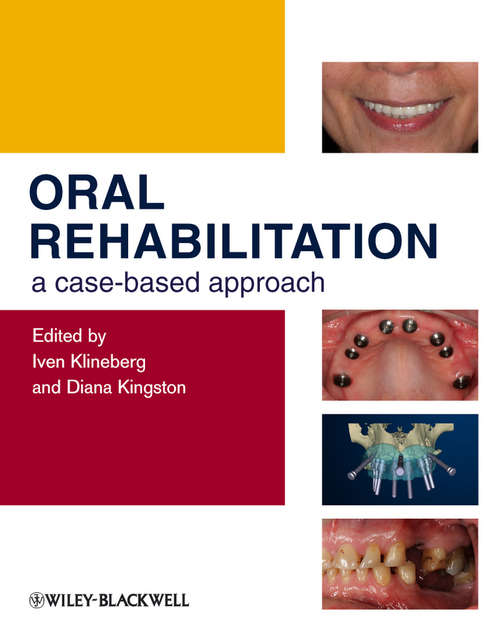 Book cover of Oral Rehabilitation: A Case-Based Approach