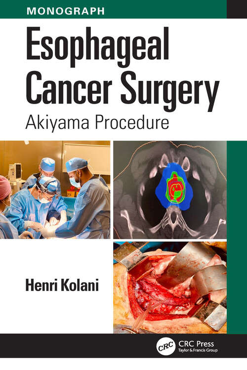 Book cover of Esophageal Cancer Surgery: Akiyama Procedure