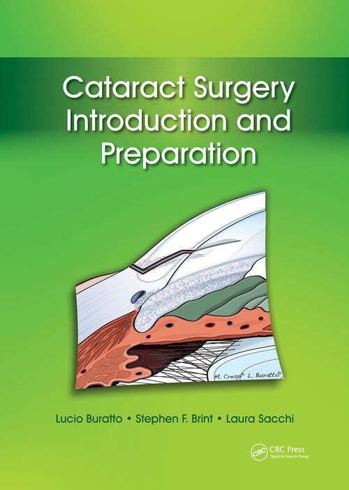 Book cover of Cataract Surgery: Introduction and Preparation