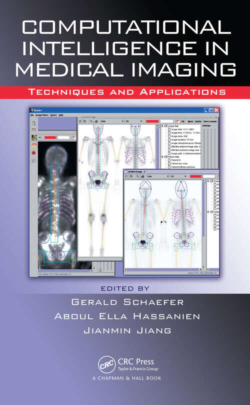 Book cover of Computational Intelligence in Medical Imaging: Techniques and Applications (1)