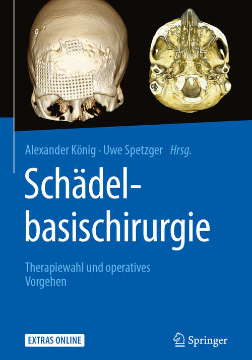 Book cover of Schädelbasischirurgie