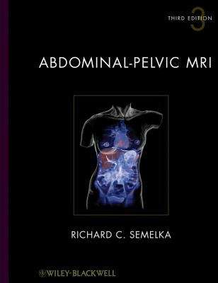 Book cover of Abdominal-Pelvic MRI