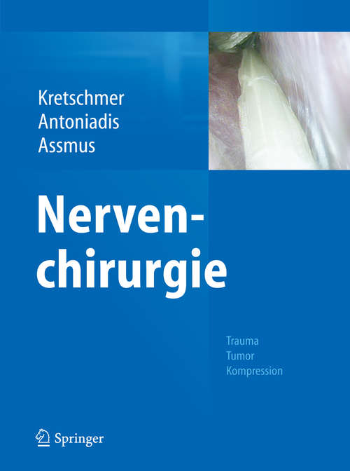 Book cover of Nervenchirurgie: Trauma, Tumor, Kompression (2014)