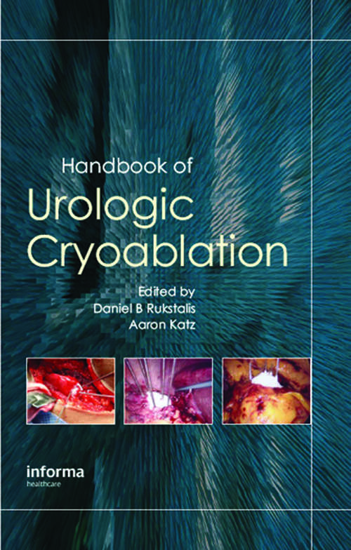 Book cover of Handbook of Urologic Cryoablation