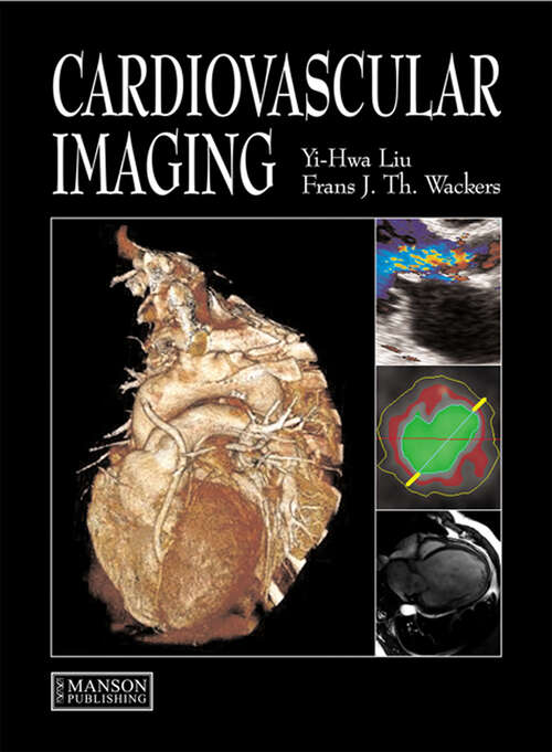 Book cover of Cardiovascular Imaging