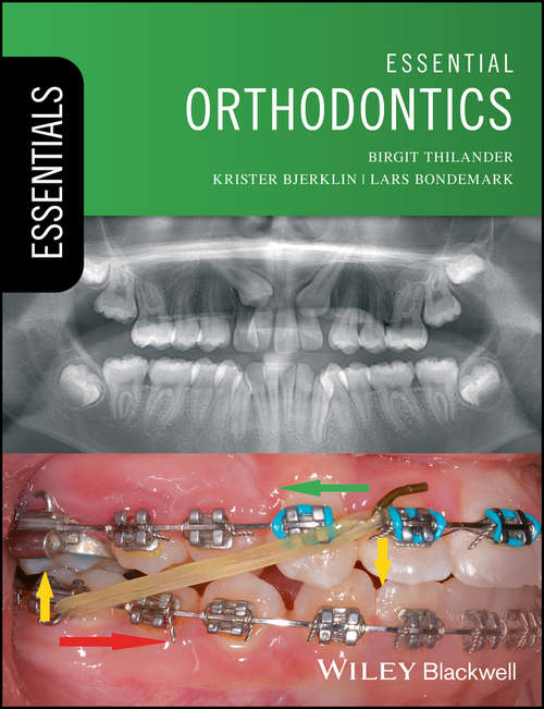 Book cover of Essential Orthodontics