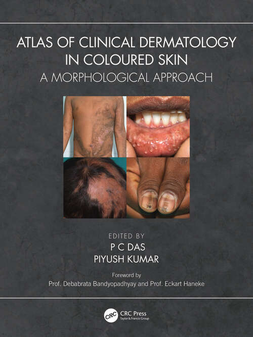 Book cover of Atlas of Clinical Dermatology in Coloured Skin: A Morphological Approach