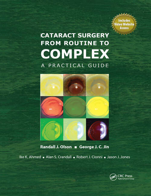 Book cover of Cataract Surgery from Routine to Complex: A Practical Guide
