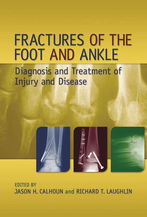 Book cover of Fractures of the Foot and Ankle: Diagnosis and Treatment of Injury and Disease