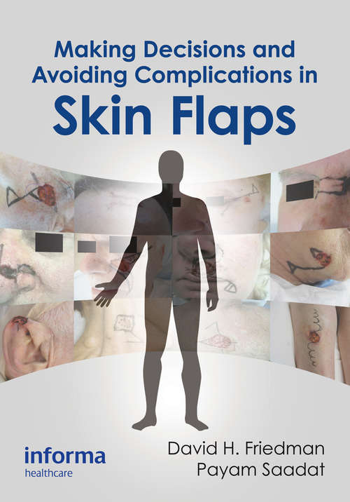 Book cover of Making Decisions and Avoiding Complications in Skin Flaps