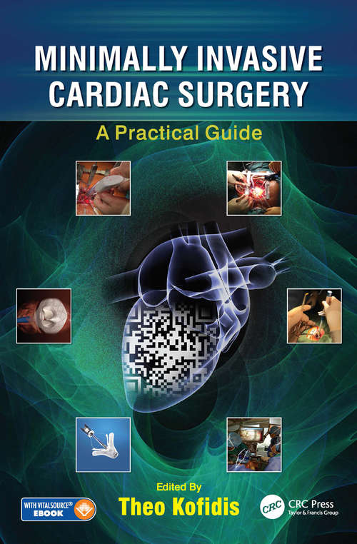 Book cover of Minimally Invasive Cardiac Surgery: A Practical Guide