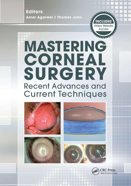 Book cover of Mastering Corneal Surgery: Recent Advances and Current Techniques
