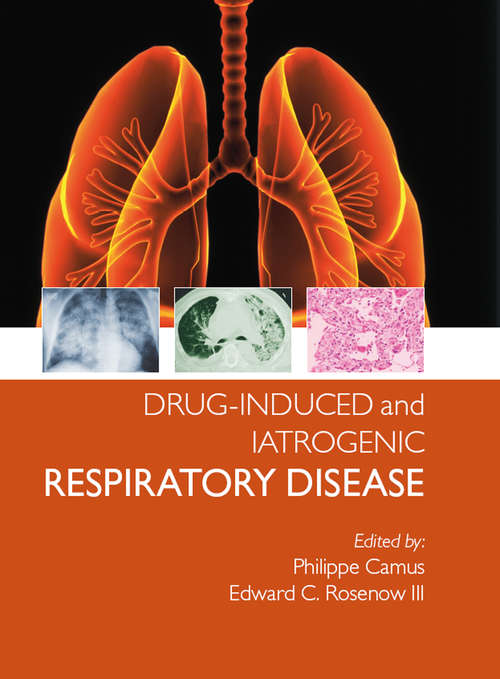 Book cover of Drug-induced and Iatrogenic Respiratory Disease