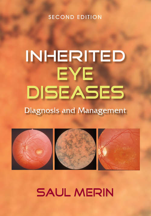 Book cover of Inherited Eye Diseases: Diagnosis and Management