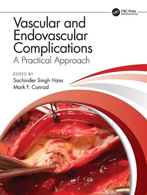 Book cover of Vascular and Endovascular Complications: A Practical Approach