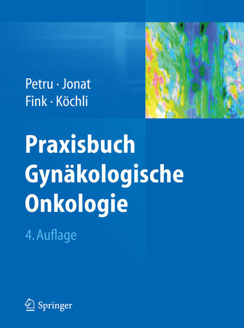Book cover of Praxisbuch Gynäkologische Onkologie