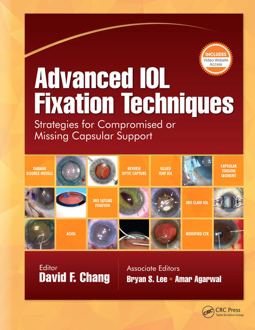 Book cover of Advanced IOL Fixation Techniques: Strategies for Compromised or Missing Capsular Support