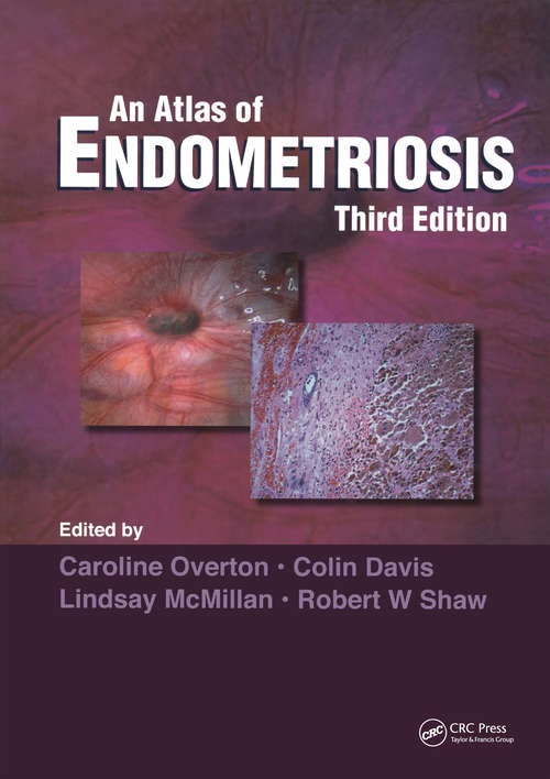 Book cover of Atlas of Endometriosis (Encyclopedia of Visual Medicine Series)