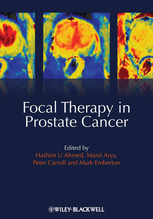 Book cover of Focal Therapy in Prostate Cancer