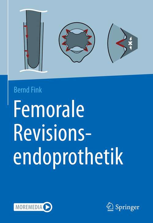 Book cover of Femorale Revisionsendoprothetik (1. Aufl. 2021)