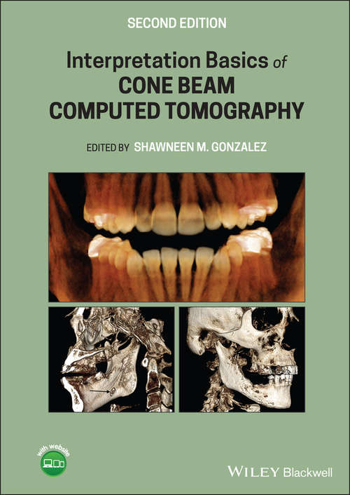 Book cover of Interpretation Basics of Cone Beam Computed Tomography (2)