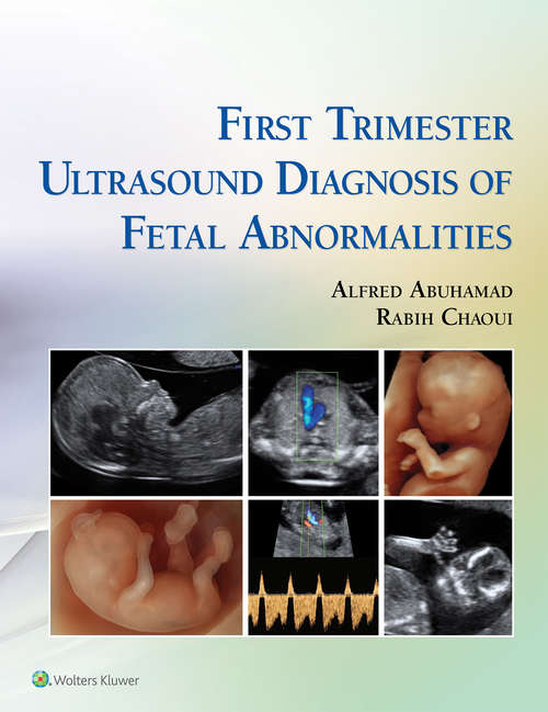 Book cover of First Trimester Ultrasound Diagnosis of Fetal Abnormalities