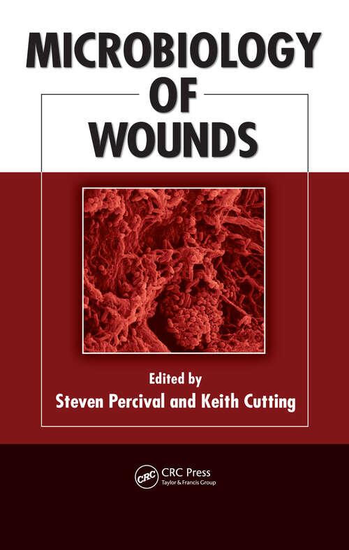 Book cover of Microbiology of Wounds