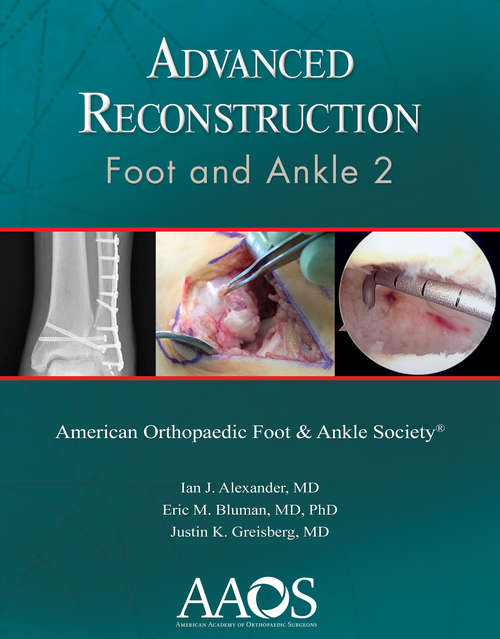Book cover of Advanced Reconstruction: Foot And Ankle 2 Ebook (2) (Advanced Reconstruction Ser.)