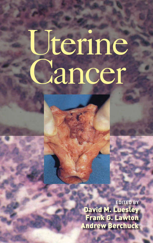 Book cover of Uterine Cancer