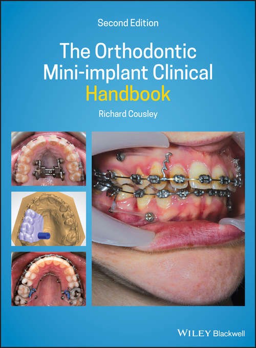 Book cover of The Orthodontic Mini-implant Clinical Handbook (2)