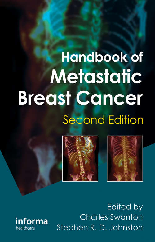 Book cover of Handbook of Metastatic Breast Cancer