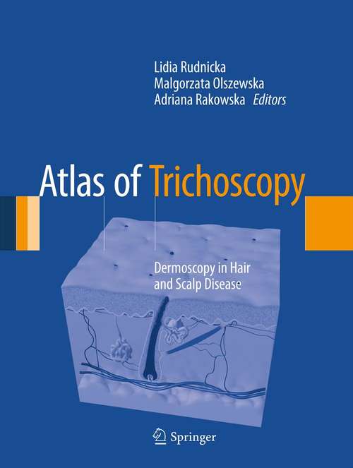 Book cover of Atlas of Trichoscopy: Dermoscopy in Hair and Scalp Disease