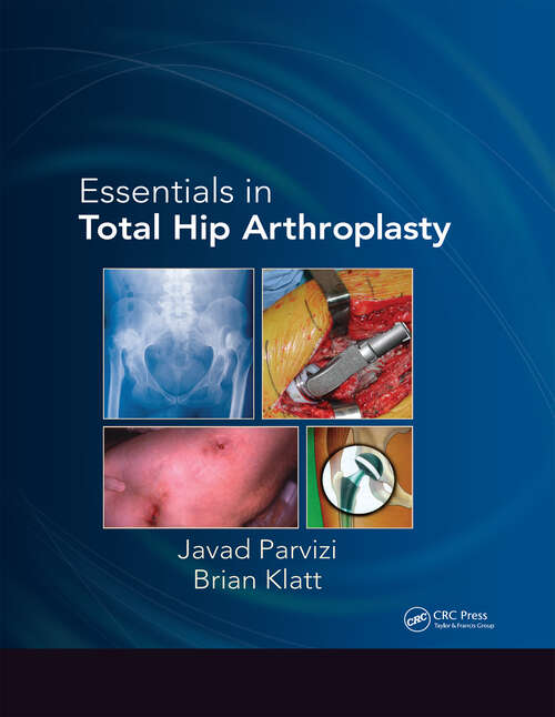 Book cover of Essentials in Total Hip Arthroplasty