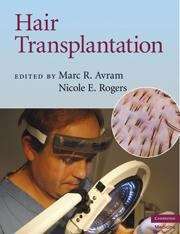 Book cover of Hair Transplantation